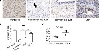 ZFAND5 Is an Independent Prognostic Biomarker of Perihilar Cholangiocarcinoma